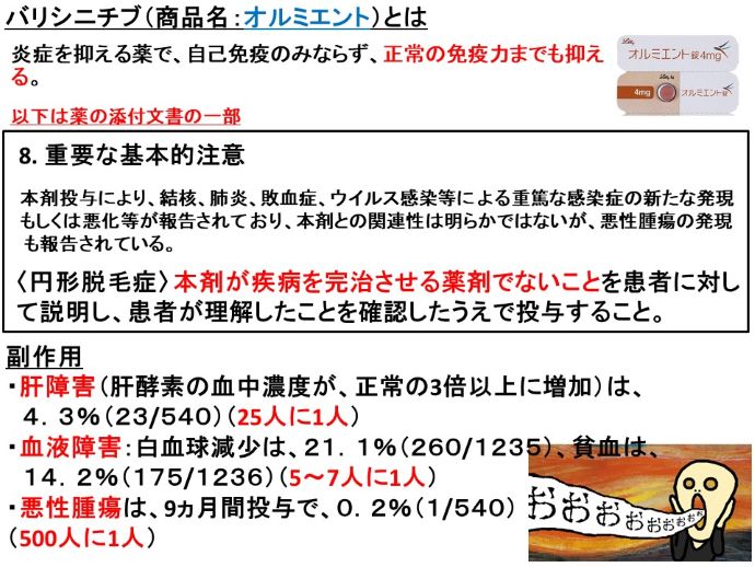 円形脱毛症　病院